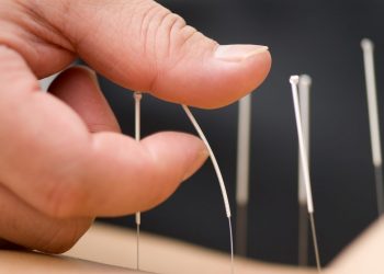 【中醫與養生】針灸用針的手法