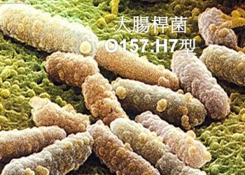 【快樂之源話健康】大腸桿菌感染