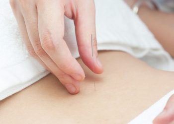 【中醫與養生】針灸過程出現暈針的現象