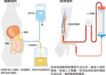 《快樂之源話健康》洗腎