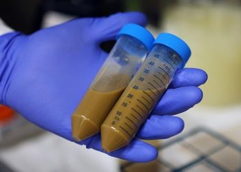 你的便便也可以捐贈和移植？荷蘭第一間「糞便銀行」開張！