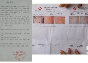 “老師紮的”！呼和浩特一幼兒園多個孩子身上發現針眼