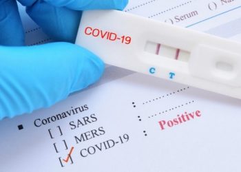 英國全民病毒大檢測 專家：弊大於利 浪費國家資源