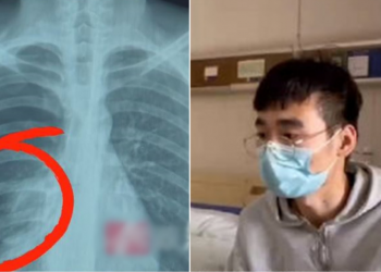 卡拉OK飆歌《新貴妃醉酒》 25歲長沙小伙險喪命