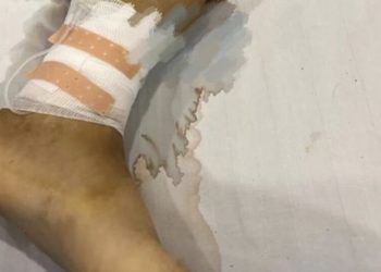 八孩母案疑團未解 江蘇小伙被騙至柬埔寨圈禁賣血瀕死