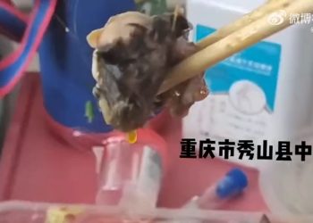 再爆「鼠頭」！重慶醫院盒飯現異物 網友急了：鼠身呢？