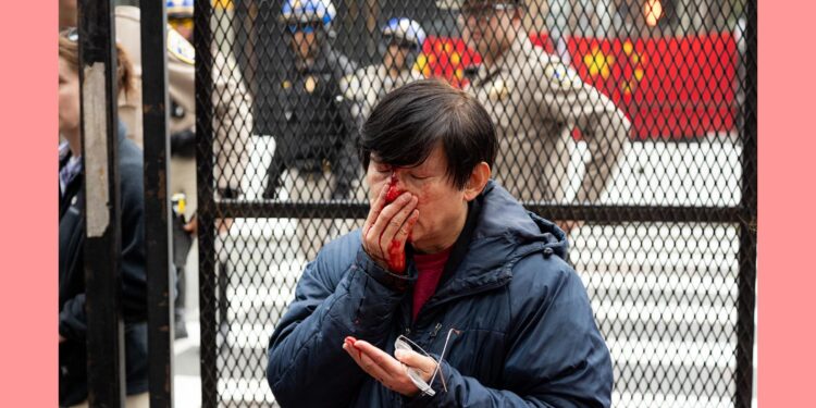 抗議者與粉紅衝突升級 中共買兇首現流血事件 界立建被捕 岸習會登場 拜登X貼文。圖為16日一名抗議男子在舊金山亞太經濟合作組織(APEC)峰會附近被親共者毆打流血。(Photo by JASON HENRY/AFP via Getty Images)