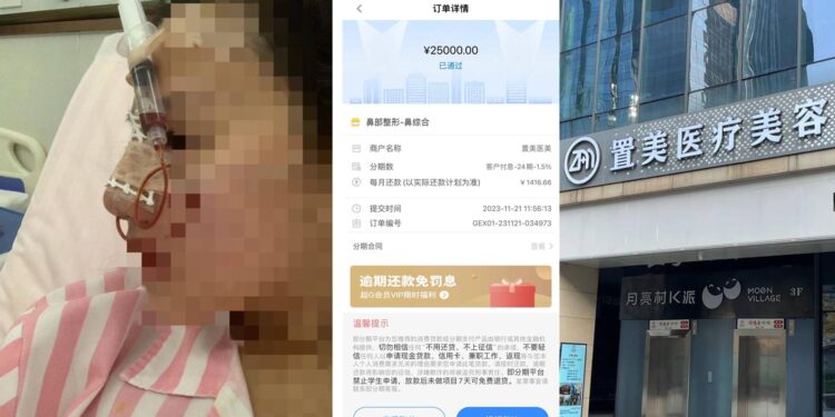 女大學生入職當天被慫恿整容 舊債未償又欠薪債(網絡圖片合成)