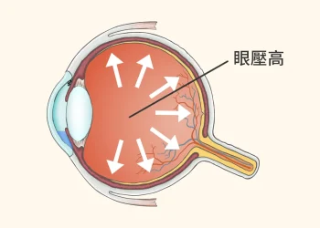 患青光眼近失明但重見光明_【廣結善緣千萬家(談天說地篇)第八十二集】